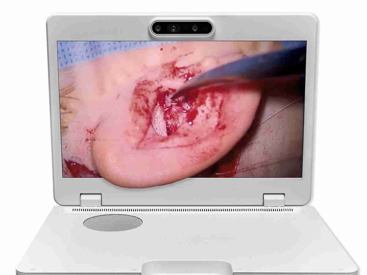 达擎之＂Heads-up 3D显微手术显示系统＂，，整合4K裸眼3D显示及眼球追踪系统，，具备快速追踪人眼移动位置功能，，，减轻医师长时间维持固定姿势的负担，，，让医师能有更宽广清晰的3D立体视野及更舒适的姿势来执行手术。。。。